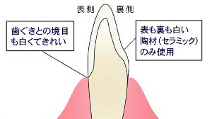 岡山県の歯医者さん・審美歯科