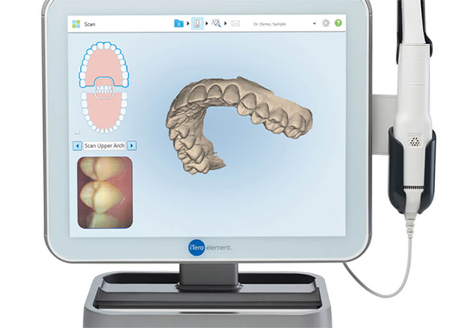 iTero(口腔内3次元スキャナー)